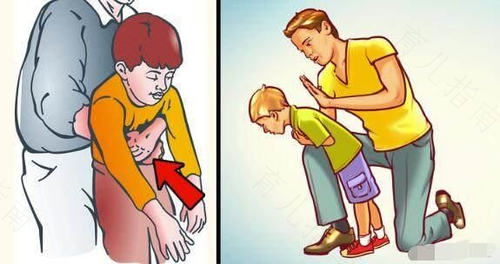 宝宝吞食了异物如何施行急救