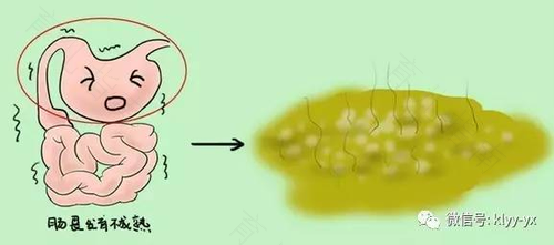 新妈妈如何观察宝宝的排泄