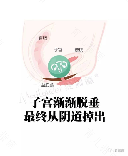 孕妇产后生殖系统有何变化 孕妇产后生殖系统有何变化