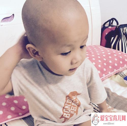 给娃剃光头真的好吗？快来看看！