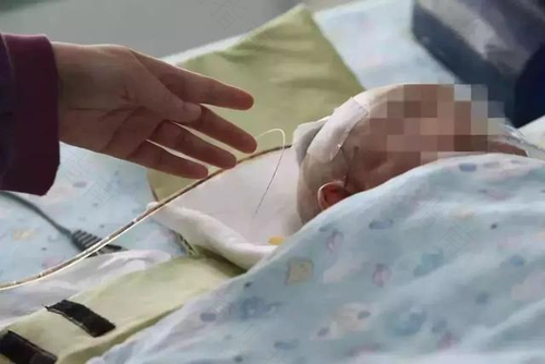 婴儿头部受伤 家长该如何处理
