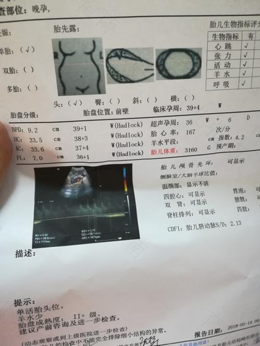 孕中期羊水偏多该怎么办? 孕中期羊水偏多该怎么办?