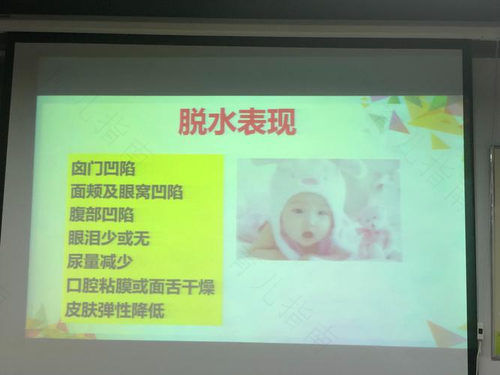 小儿失水的症状及护理方案
