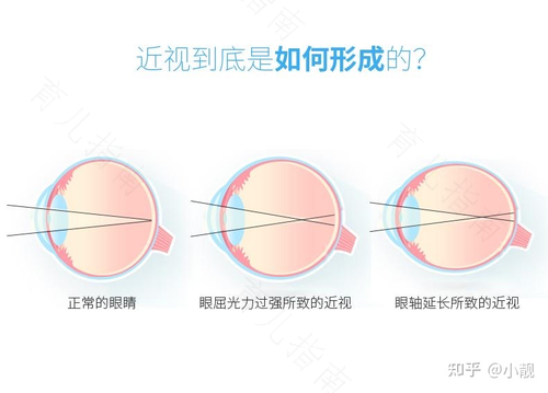 各国护眼“招式”大不同，原来预防孩子近视这么简单！