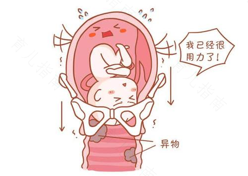 剖还是顺？这是个问题！