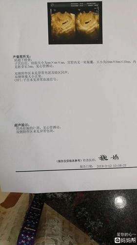 怀孕第七周之48天