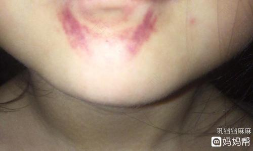 4-5月的宝宝 嘴巴一定要管”好 4-5月的宝宝 嘴巴一定要管”好