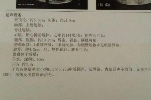 别担忧 产检没什么好怕