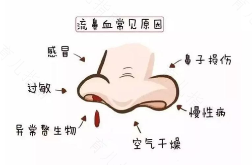 一起来了解儿童流鼻血的原因和治疗方法吧！