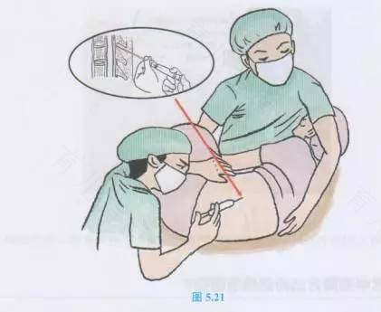 生宝宝到底要不要做硬膜外麻醉