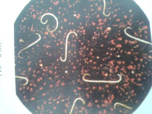 宝宝肠道感染寄生虫后护理与治疗 宝宝肠道感染寄生虫后护理与治疗