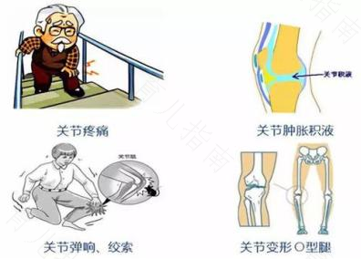 婴幼儿关节痛的症状及护理方案