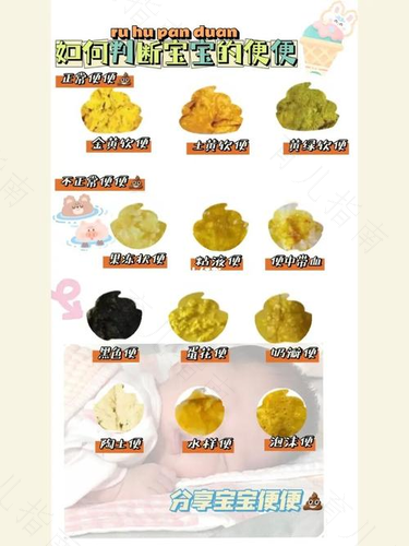 怎样看懂宝宝的大小便