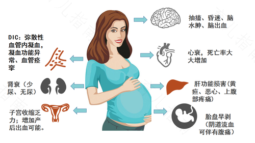 妊娠高血压的预防与治疗