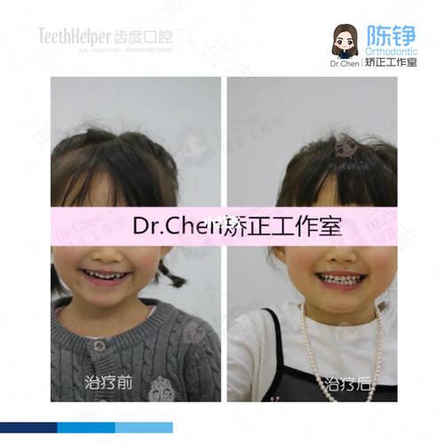 有缺陷的小孩更要及早矫正