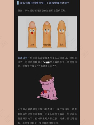治疗小儿包茎的原则及方法