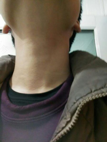 父亲如何帮孩子对待青春期男孩的喉结变化