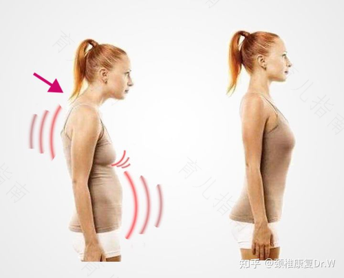 五大不良姿势影响胸部健康 五大不良姿势影响胸部健康