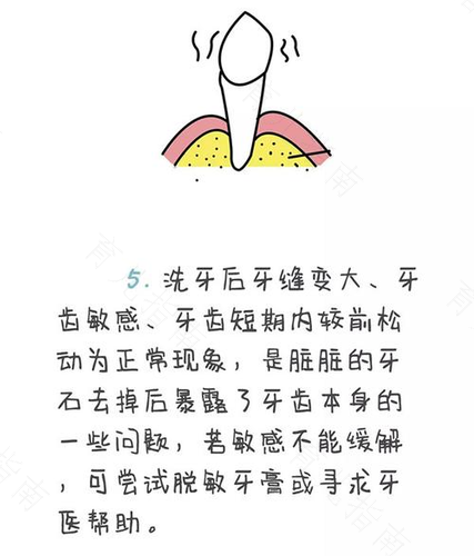 准妈妈别忘了护牙洁齿