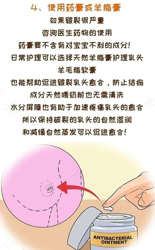 新妈妈如何防治乳头皲裂 新妈妈如何防治乳头皲裂