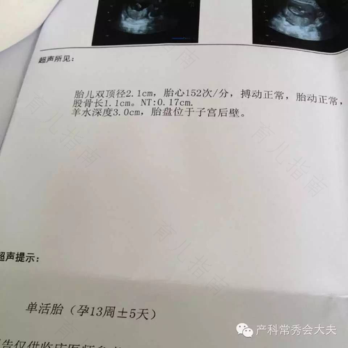 怀孕4-8周内服药胎儿容易畸形