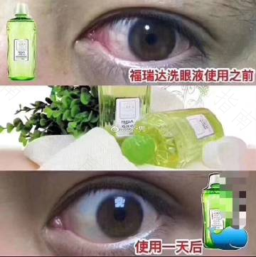 眼药水含防腐剂，正在入侵你的眼