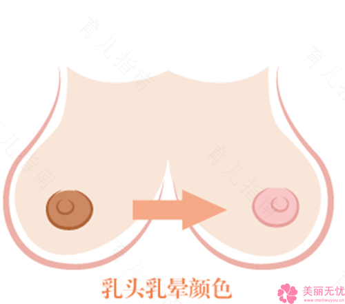 正常的乳晕是什么样的? 正常的乳晕是什么样的?