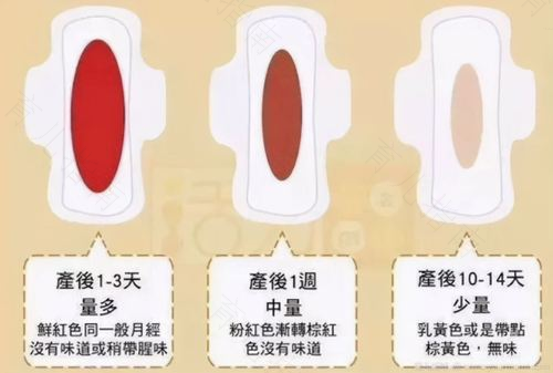 产后恶露不绝　良方来帮忙