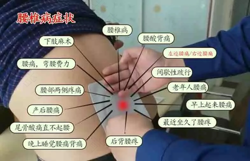左侧腰疼是怎么回事女性 左侧腰疼是怎么回事女性