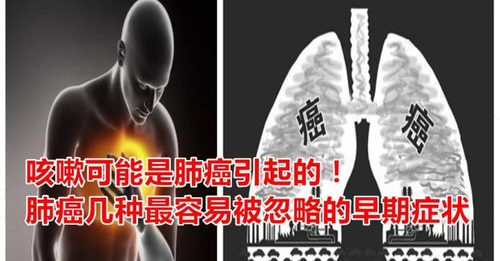 一直咳嗽是不是肺有问题 一直咳嗽是不是肺有问题