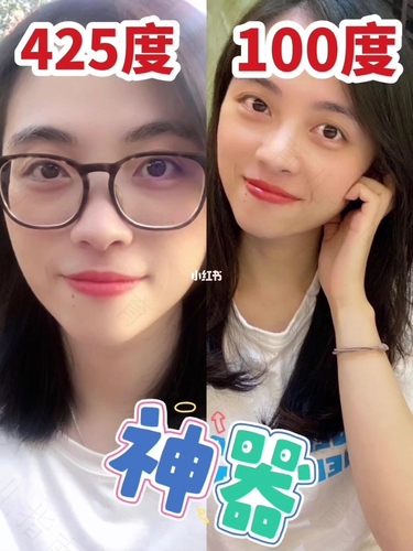 近视325度严重吗