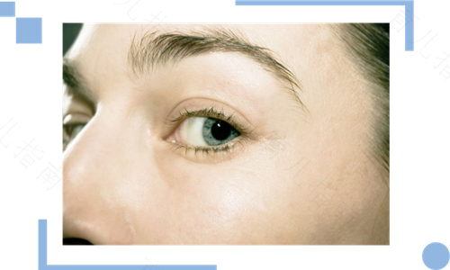 经常玩手机眼睛变小了怎么办