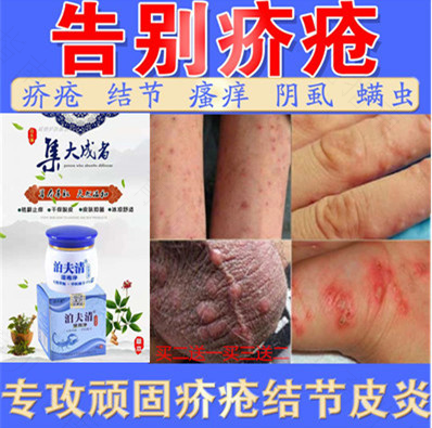 疥疮和湿疹怎么区分? 疥疮和湿疹怎么区分?