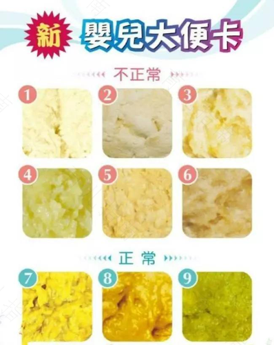 突然水样腹泻什么原因 突然水样腹泻什么原因