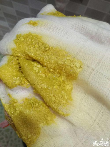 宝宝换了奶粉便便就不好了怎么回事? 宝宝换了奶粉便便就不好了怎么回事?