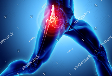 股骨头有弹响是什么原因 股骨头有弹响是什么原因