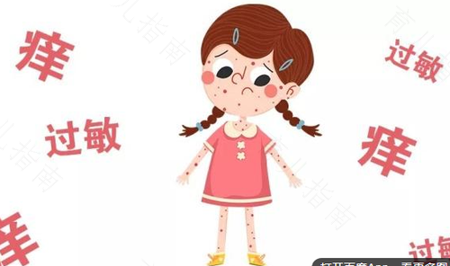 过敏体质的人多吗 过敏体质的人多吗