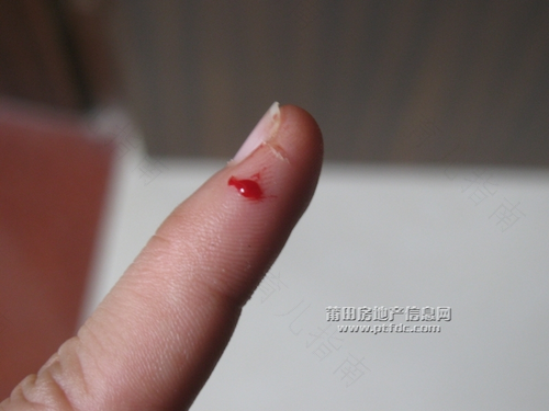 手指被刀切伤很深怎么办