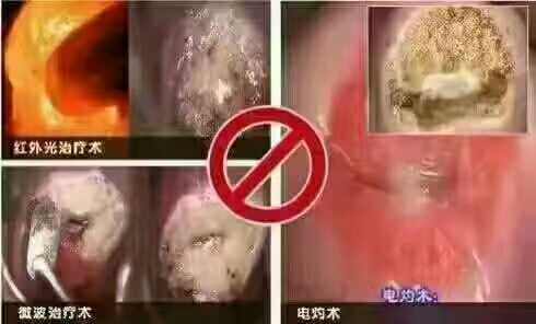 宫颈糜烂手术后需要打针消炎吗 宫颈糜烂手术后需要打针消炎吗