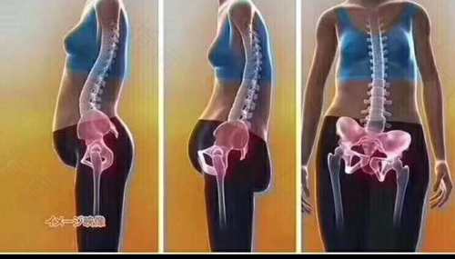 胯骨内侧疼是怎么回事女性 胯骨内侧疼是怎么回事女性