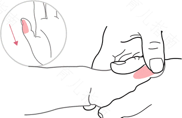 湿疹可以推拿好吗 湿疹可以推拿好吗