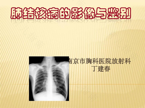 肺结核早期会胸疼吗 肺结核早期会胸疼吗