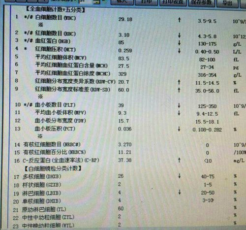 血常规如何排除白血病知乎 血常规如何排除白血病知乎