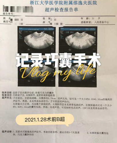 巧囊术后粘连症状如何检查 巧囊术后粘连症状如何检查