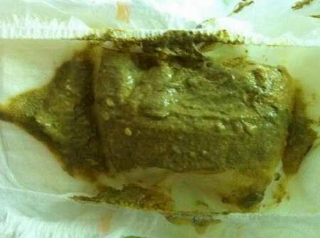 大便有氨气味怎么回事