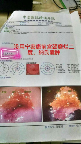 宫颈1度糜烂严重吗? 宫颈1度糜烂严重吗?
