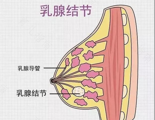 乳腺3类和4类的区别 乳腺3类和4类的区别