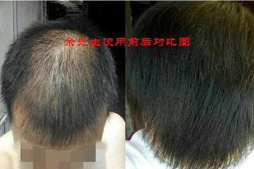 头顶正中疼是怎么回事中医 头顶正中疼是怎么回事中医