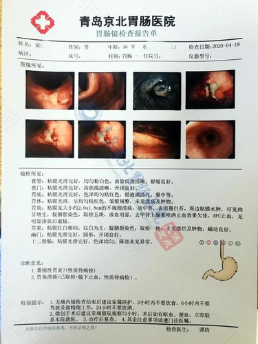 做完胃镜后胃不舒服怎么办 做完胃镜后胃不舒服怎么办