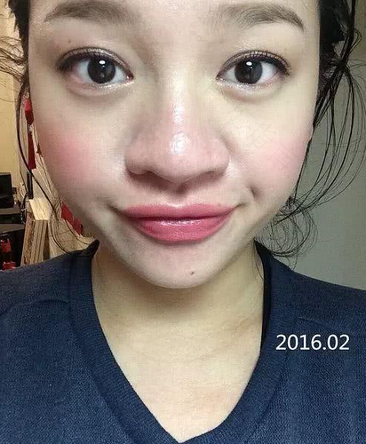 什么原因导致鼻头变大吗 什么原因导致鼻头变大吗